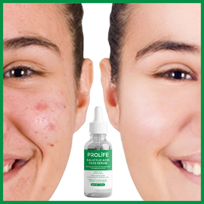 Salicylic Acid Face Serum